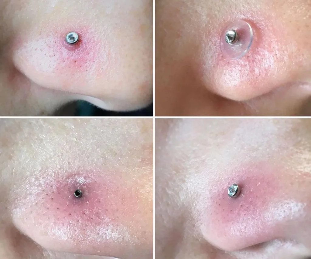 Can I Use Himalayan Salt to Clean My Piercing