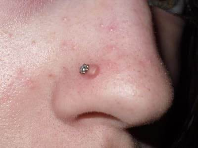 Can I Use Himalayan Salt to Clean My Piercing